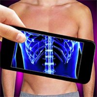 Funny Bone Surgery Online Arcade Game